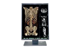 Monitores de grado médico